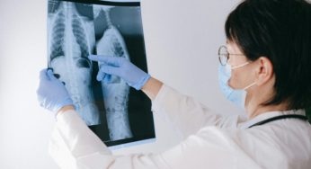 Exames contrastados: A evolução da imagem médica para diagnósticos cada vez mais precisos